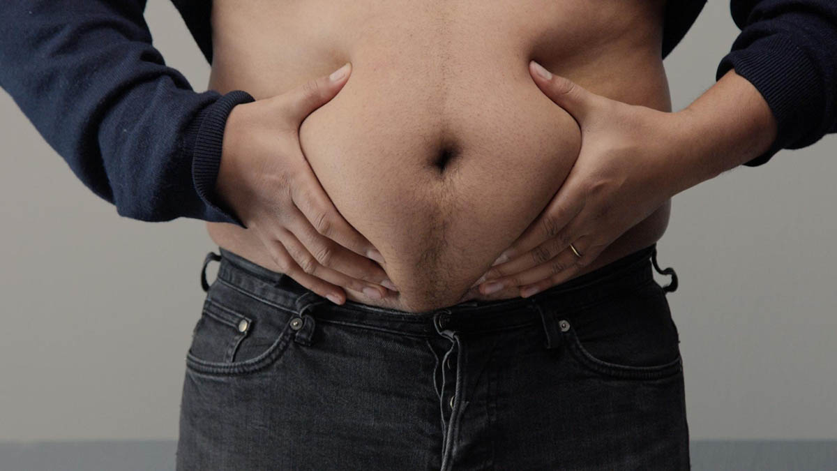 What Are the Symptoms of Diastasis Recti in Men?