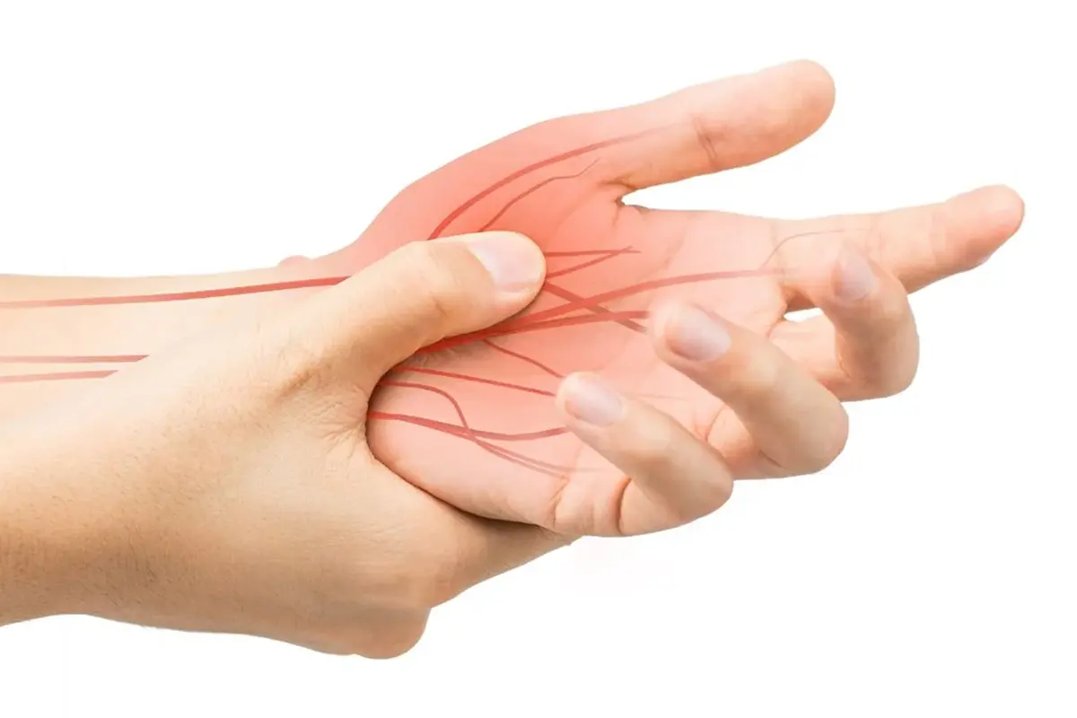 Top 5 Ways to Relieve Nerve Pain in Your Hand